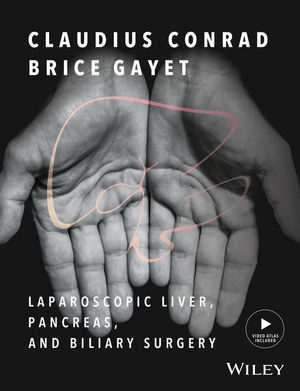 Laparoscopic Liver Pancreas and Biliary Surgery: Textbook and Illustrated Video Atlas