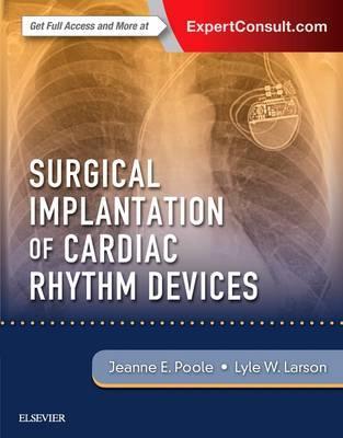 Surgical Implantation of Cardiac Rhythm Devices 1판