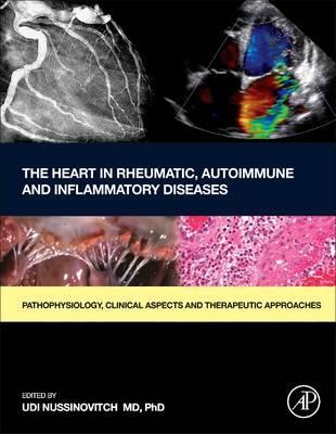 The Heart in Rheumatic Autoimmune and Inflammatory Diseases 1판
