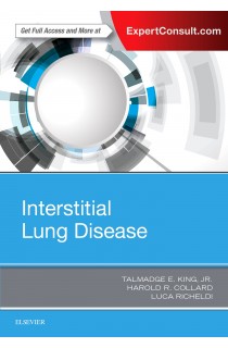 Interstitial Lung Disease