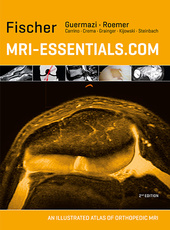 MRI-Essentials.com-2판 : An illustrated atlas of orthopedic MRI
