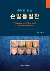 증례로 보는 손발톱질환-Diseases of the Nail 2판