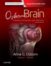 Osborn's Brain 2판