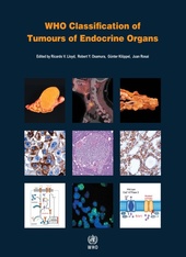 WHO Classification of Tumours of Endocrine Organs-4판