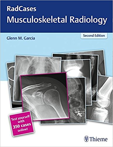 Radcases Musculoskeletal Radiology 2판