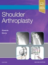 Shoulder Arthroplasty-2판