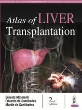 Atlas of Liver Transplantation-2판