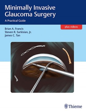 Minimally Invasive Glaucoma Surgery : A Practical Guide