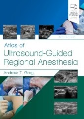 Atlas of Ultrasound-Guided Regional Anesthesia-3판