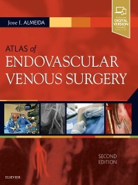 Atlas of Endovascular Venous Surgery-2판
