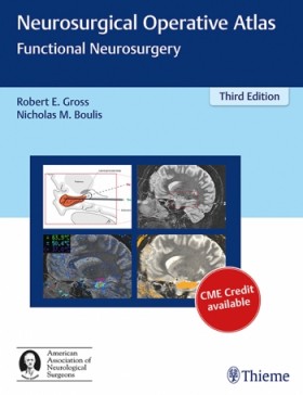 Neurosurgical Operative Atlas : Functional Neurosurgery-3판