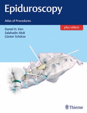 Epiduroscopy : Atlas of Procedures-1판