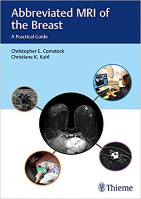 Abbreviated MRI of the Breast: A Practical Guide-1판