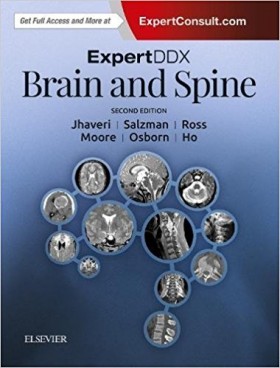 ExpertDDx: Brain and Spine 2판