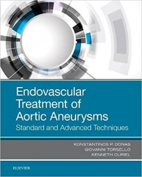 Endovascular Treatment of Aortic Aneurysms-1판				