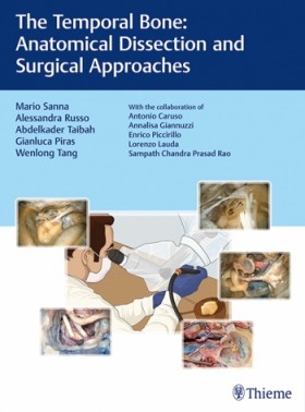 The Temporal Bone Anatomical Dissection and Surgical Approaches-1판