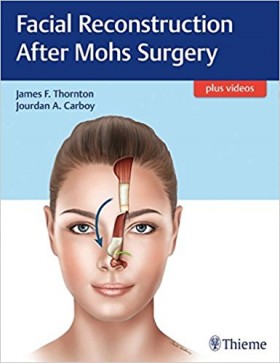 Facial Reconstruction After Mohs Surgery-1판