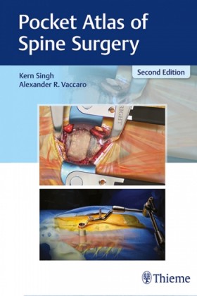 Pocket Atlas of Spine Surgery-2판