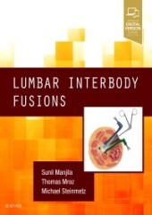 Lumbar Interbody Fusions-1판