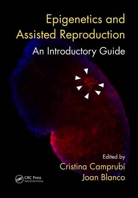 Epigenetics and Assisted Reproduction: An Introductory Guide-1판