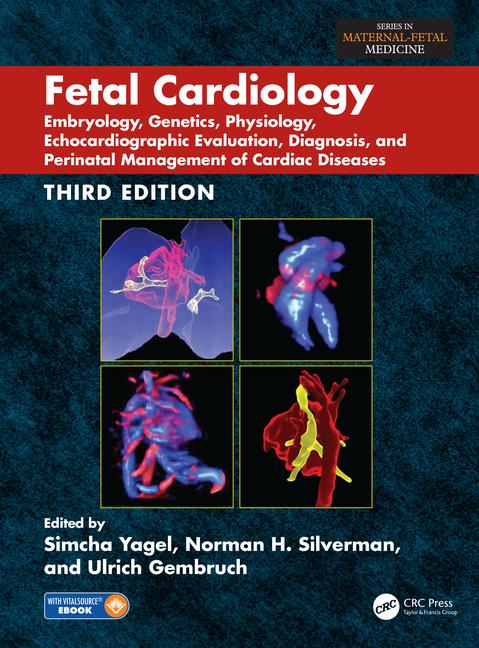 Fetal Cardiology-3판