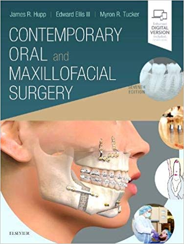 Contemporary Oral and Maxillofacial Surgery-7판