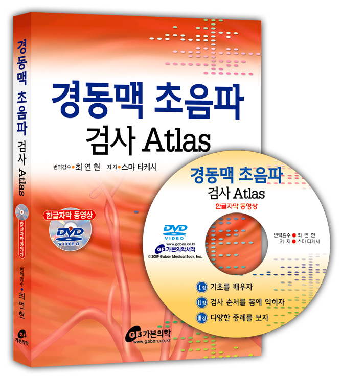 경동맥초음파검사 Atlas