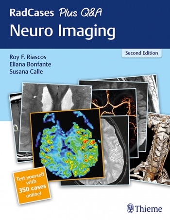RadCases Plus QandA Neuro Imaging-2판