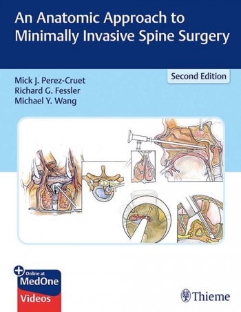 An Anatomic Approach to Minimally Invasive Spine Surgery-2판