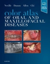 Color Atlas of Oral and Maxillofacial Diseases-1판
