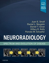 Neuroradiology: Spectrum and Evolution of Disease-1판