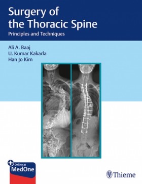 Surgery of the Thoracic Spine Principles and Techniques-1판