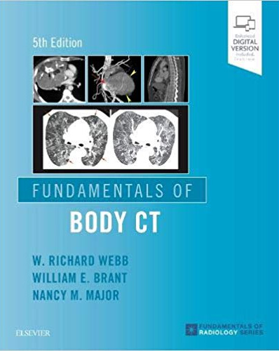 Fundamentals of Body CT-5판