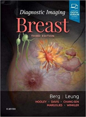 Diagnostic Imaging: Breast-3판