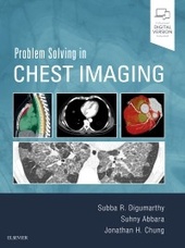 Problem Solving in Chest Imaging-1판