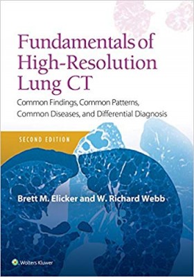 Fundamentals of High-Resolution Lung CT-2판