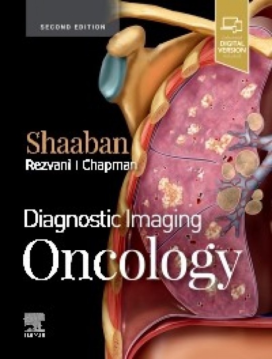Diagnostic Imaging: Oncology-2판