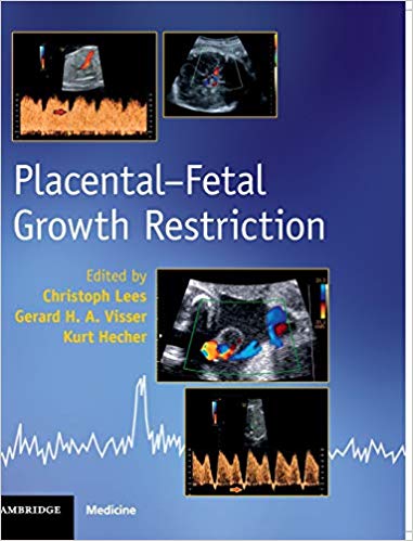 Placental-Fetal Growth Restriction-1and#54032;