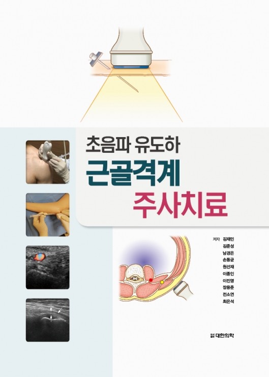 초음파 유도하 근골격계 주사치료