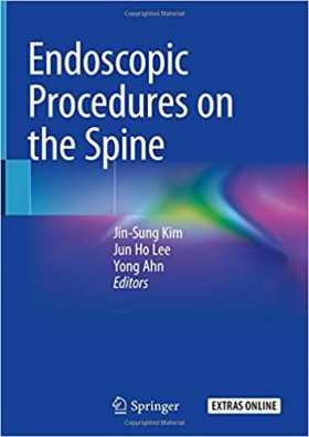 Endoscopic Procedures on the Spine-1판(Hardcover)