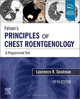 Felson's Principles of Chest Roentgenology-5판