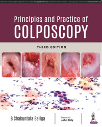 Principles and Practice of Colposcopy-3판
