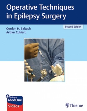 Operative Techniques in Epilepsy Surgery-2판