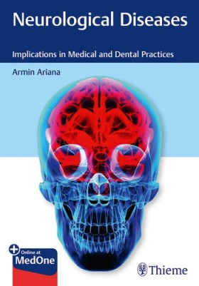Neurological Diseases-1판(Paperback)