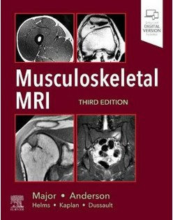 Musculoskeletal MRI-3판