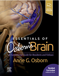 Essentials of Osborn's Brain-1판