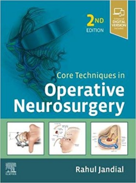 Core Techniques in Operative Neurosurgery-2판