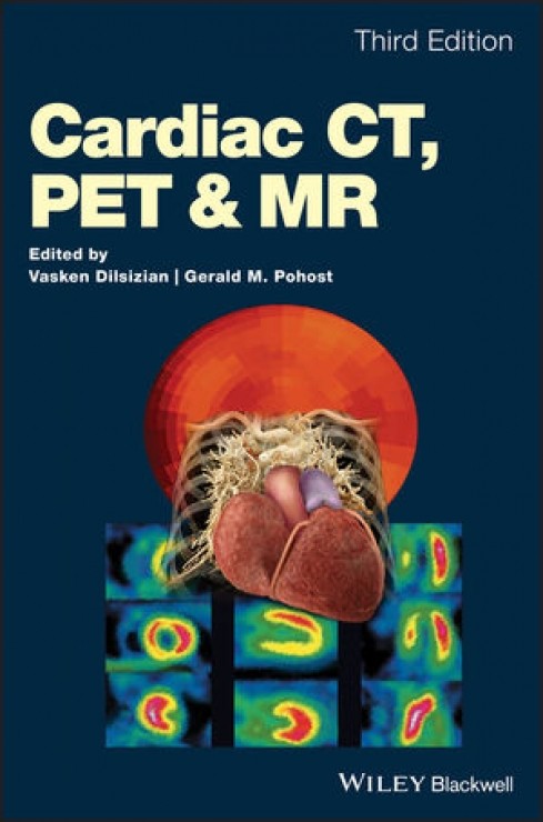 Cardiac CT PET and MR-3판