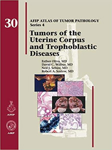 Tumors of the Uterine Corpus and Gestational Trophoblastic Diseases