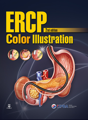 ERCP Color Illustration 2판